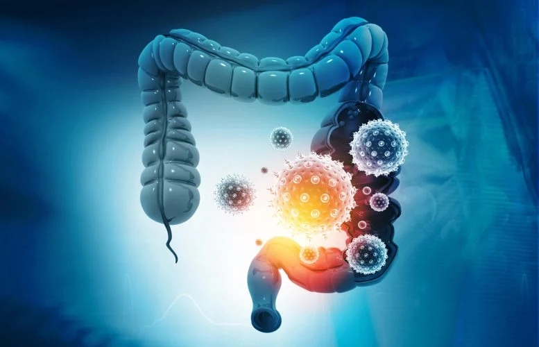 Gut Microbiome cancer